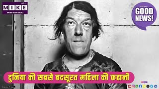 Mary Ann Bevan Story: दुनिया की 'सबसे बदसूरत महिला' की कहानी | ugliest woman in the world